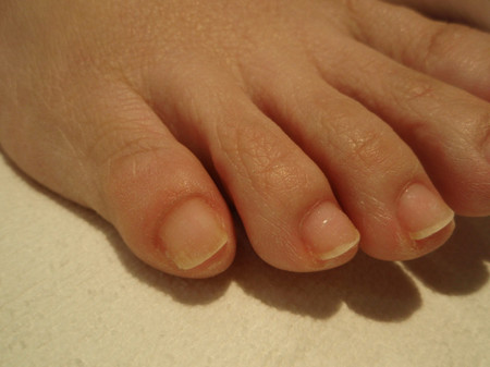 足の小指の爪は どうして押し潰されたような形になっているの 京子先生のネイルビューティーダイアリー